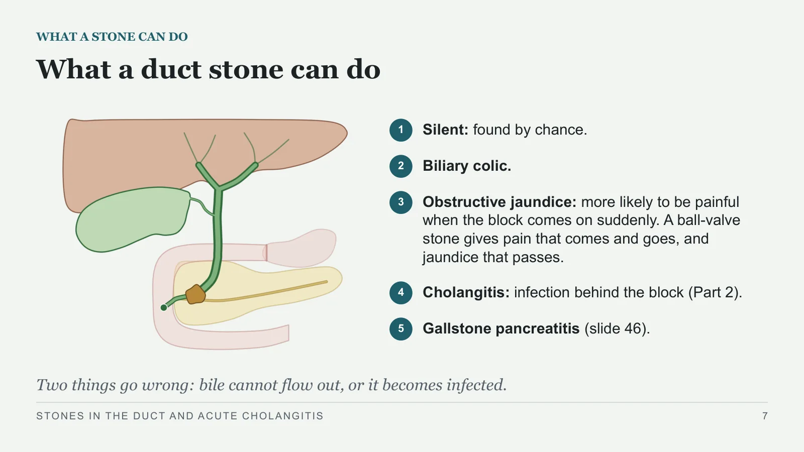 Slide 7: What a duct stone can do