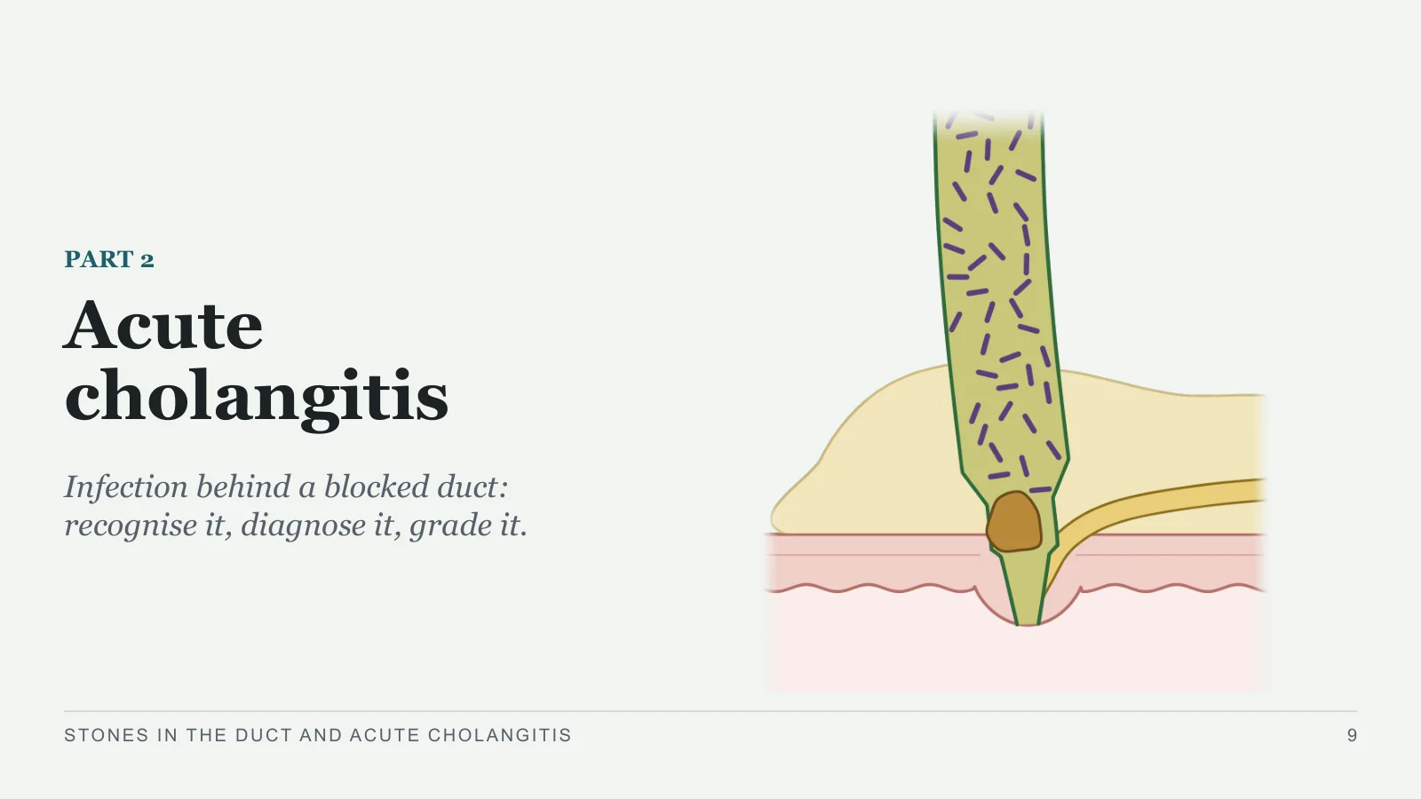 Slide 9: Acute cholangitis