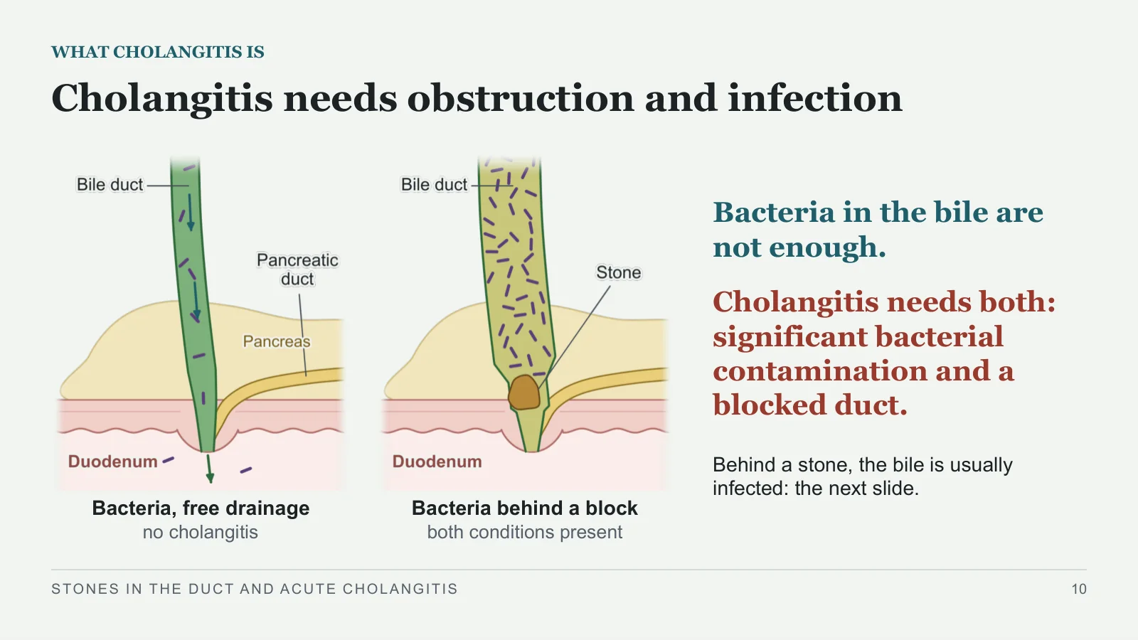 Slide 10: Cholangitis needs obstruction and infection