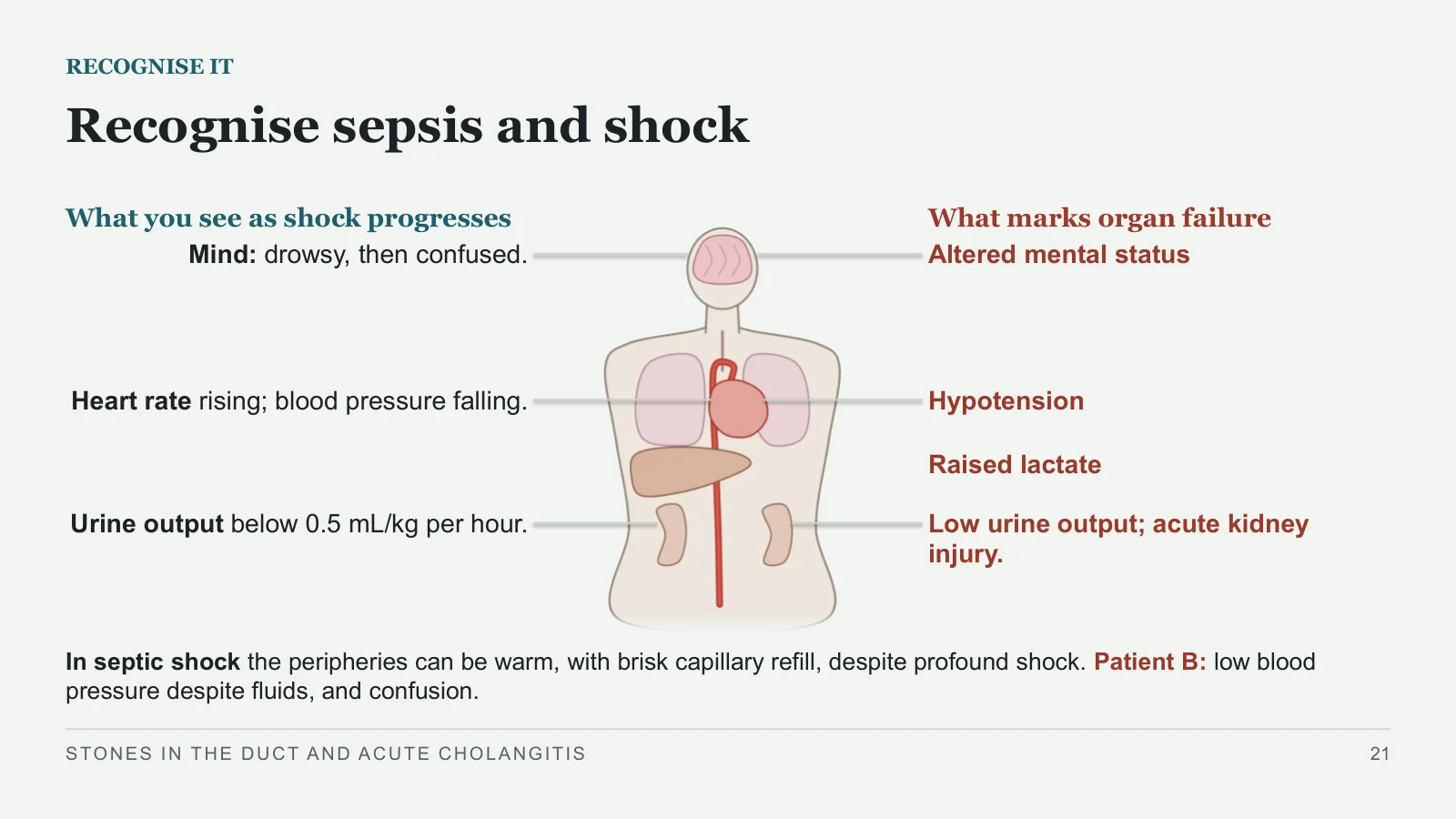 Slide 21: Recognise sepsis and shock