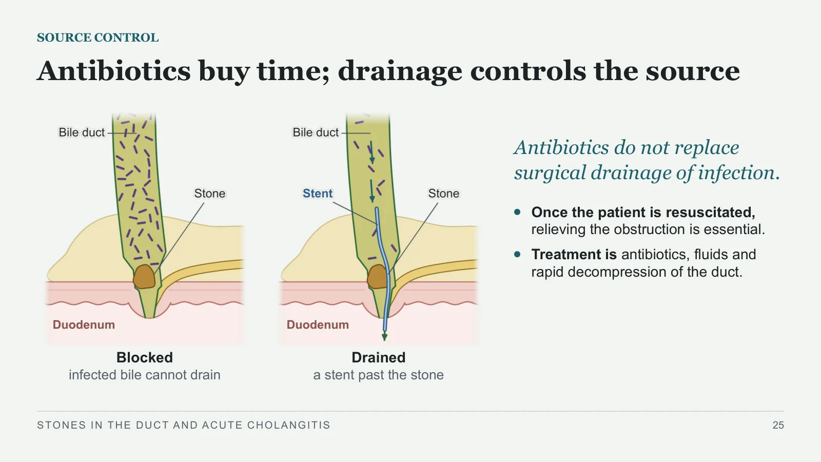 Slide 25: Antibiotics buy time; drainage controls the source