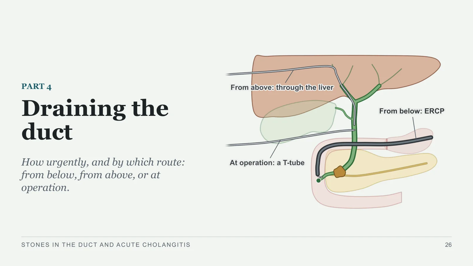Slide 26: Draining the duct