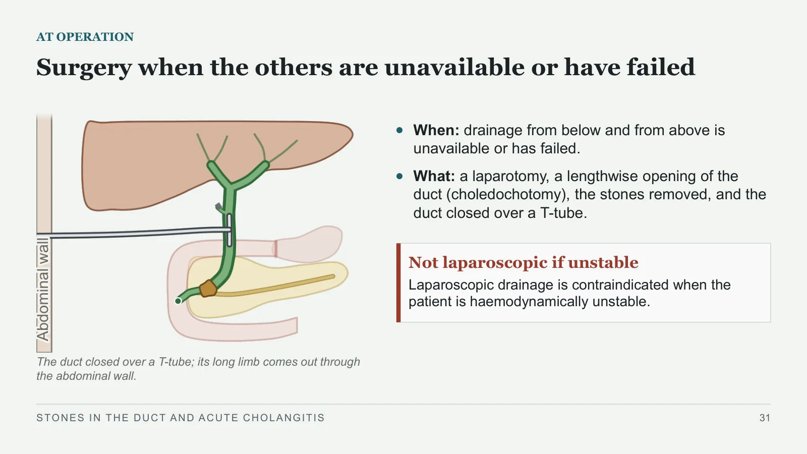 Slide 31: Surgery when the others are unavailable or have failed