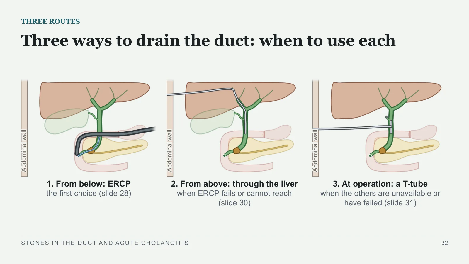 Slide 32: Three ways to drain the duct: when to use each