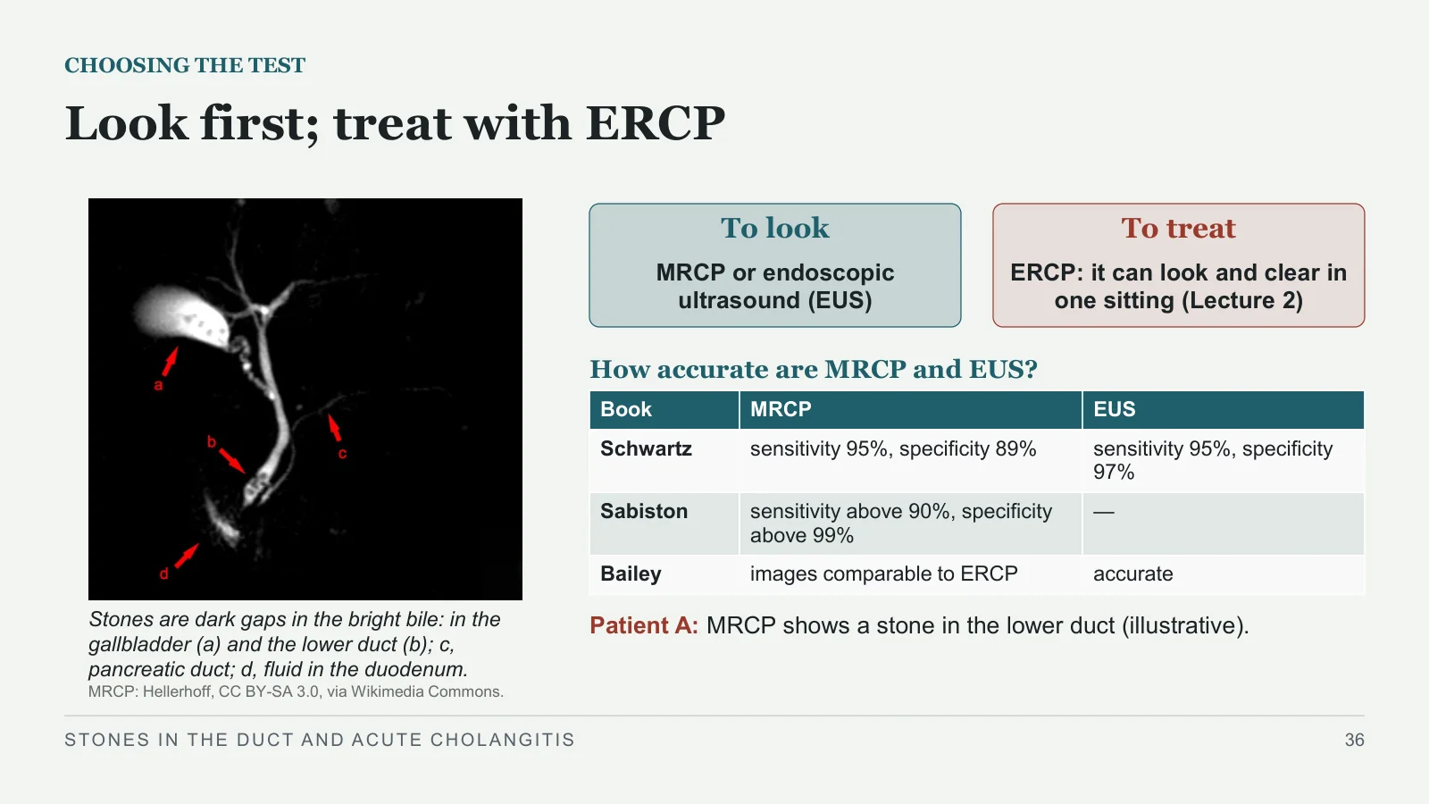 Slide 36: Look first; treat with ERCP