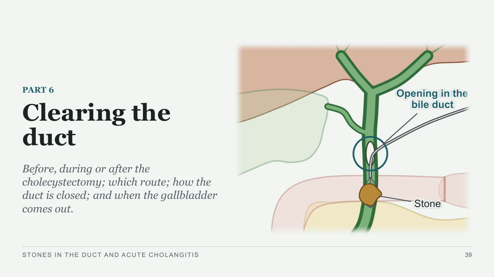 Slide 39: Clearing the duct