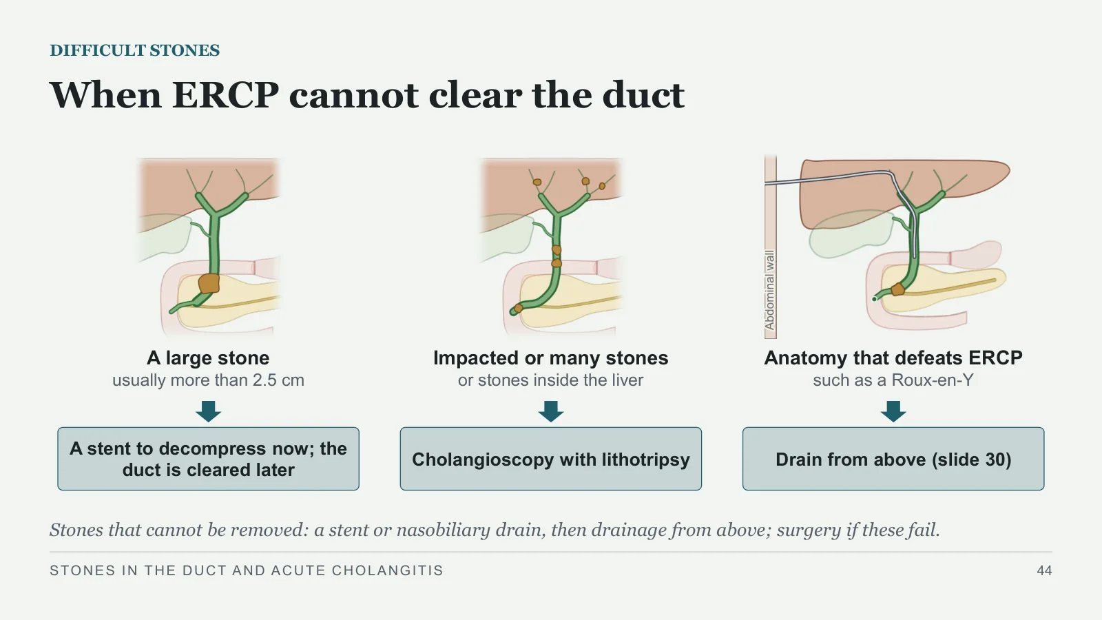 Slide 44: When ERCP cannot clear the duct