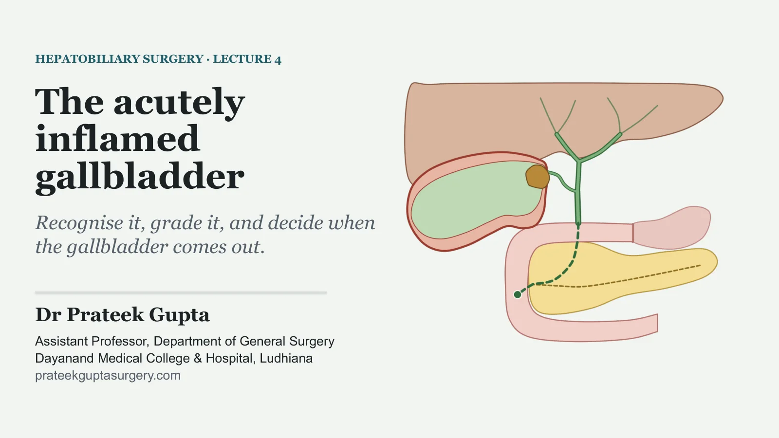 Slide 1: The acutely inflamed gallbladder