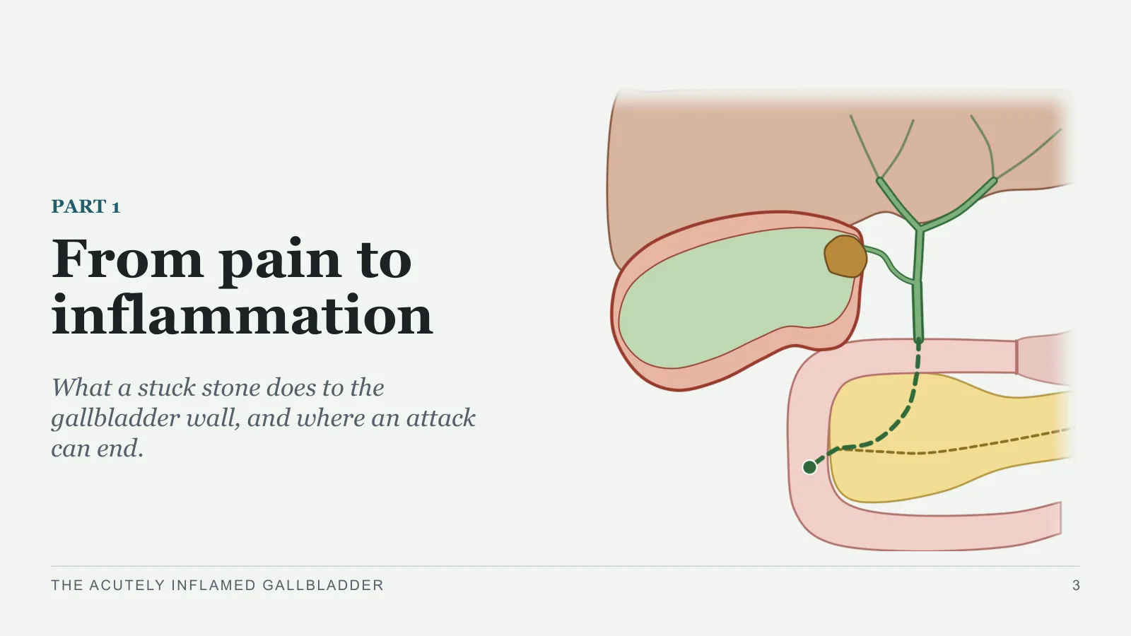 Slide 3: From pain to inflammation
