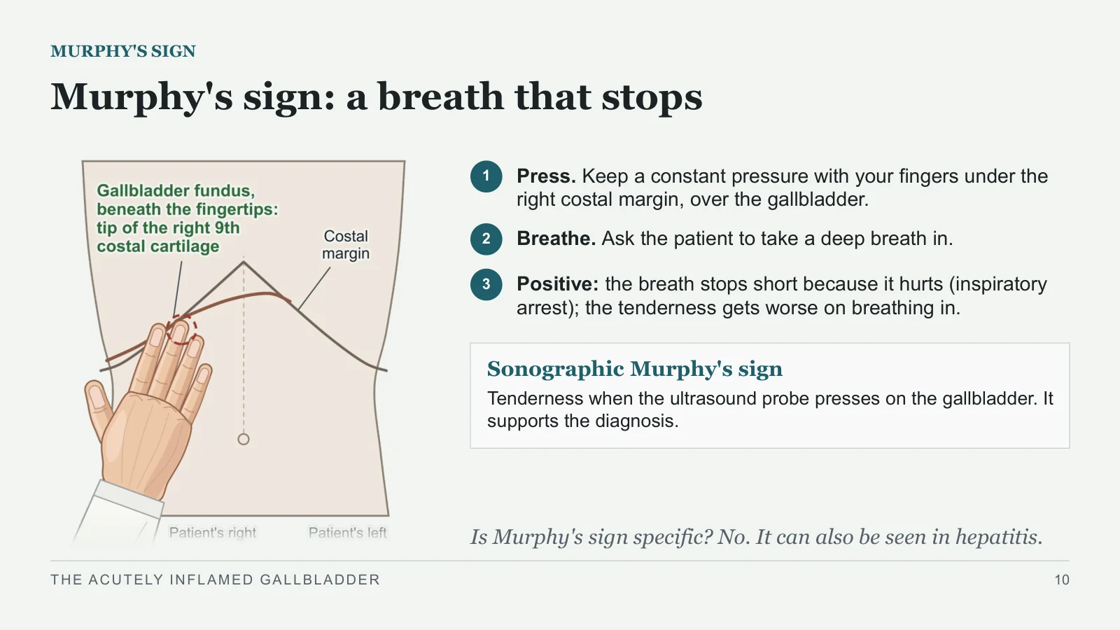 Slide 10: Murphy's sign: a breath that stops