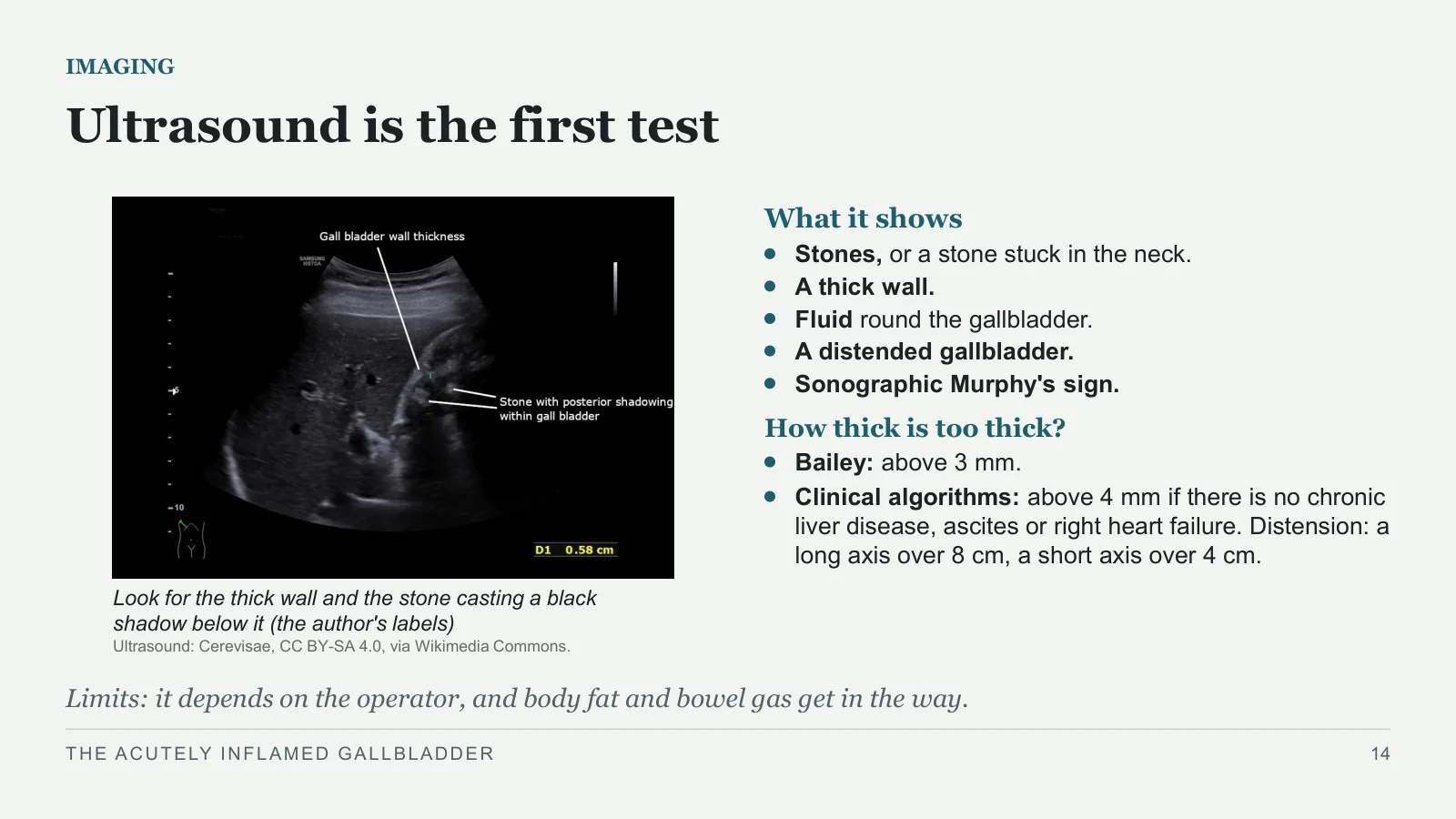 Slide 14: Ultrasound is the first test