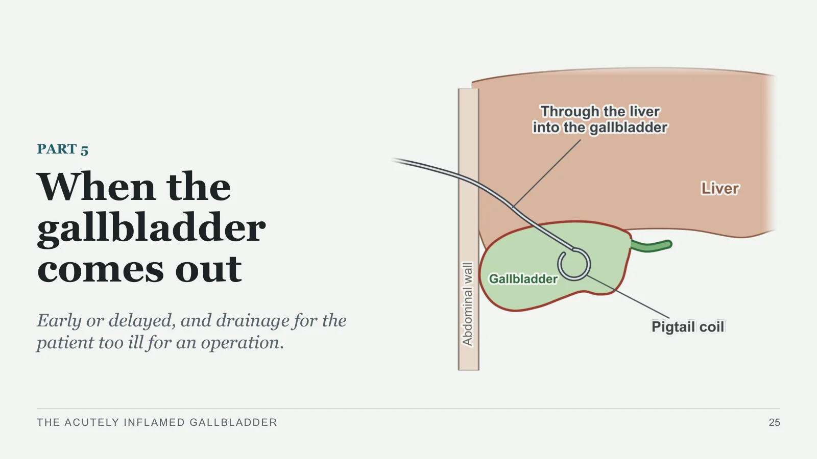 Slide 25: When the gallbladder comes out
