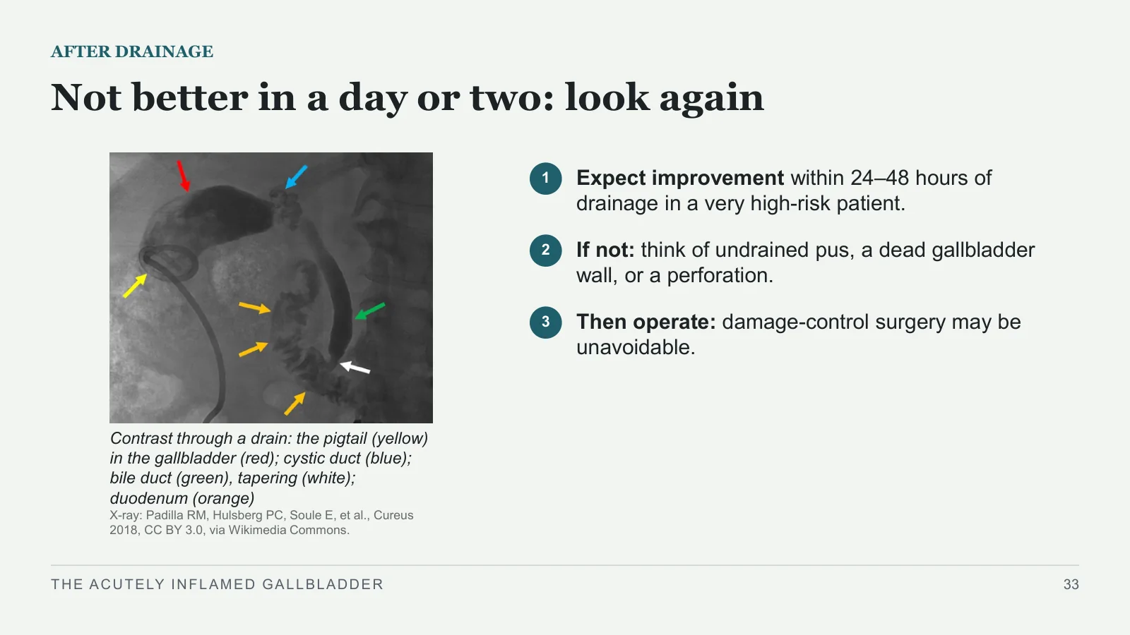 Slide 33: Not better in a day or two: look again
