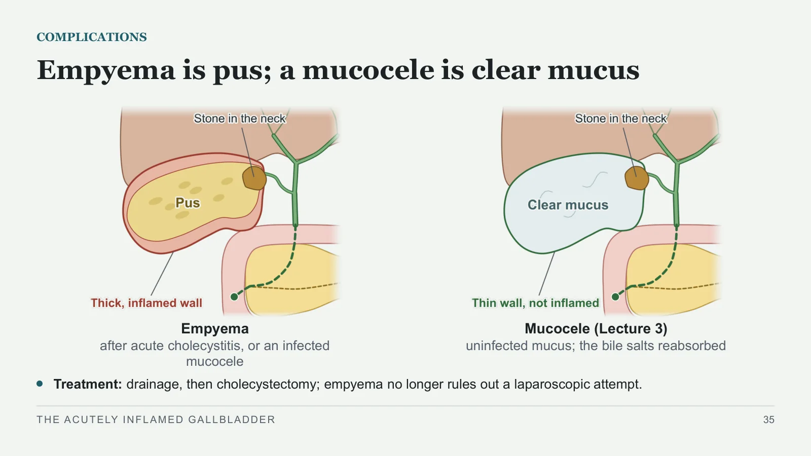 Slide 35: Empyema is pus; a mucocele is clear mucus