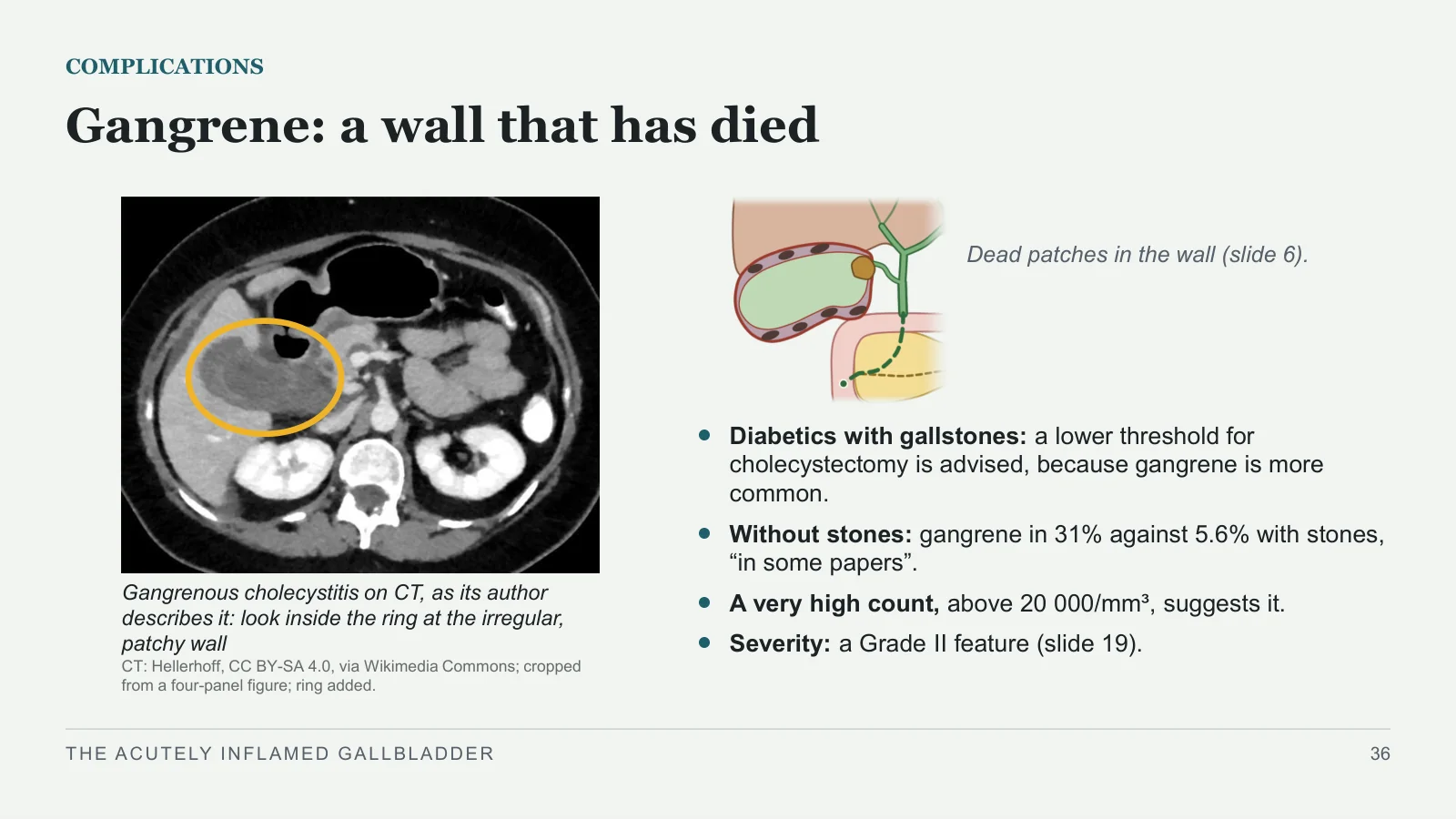 Slide 36: Gangrene: a wall that has died