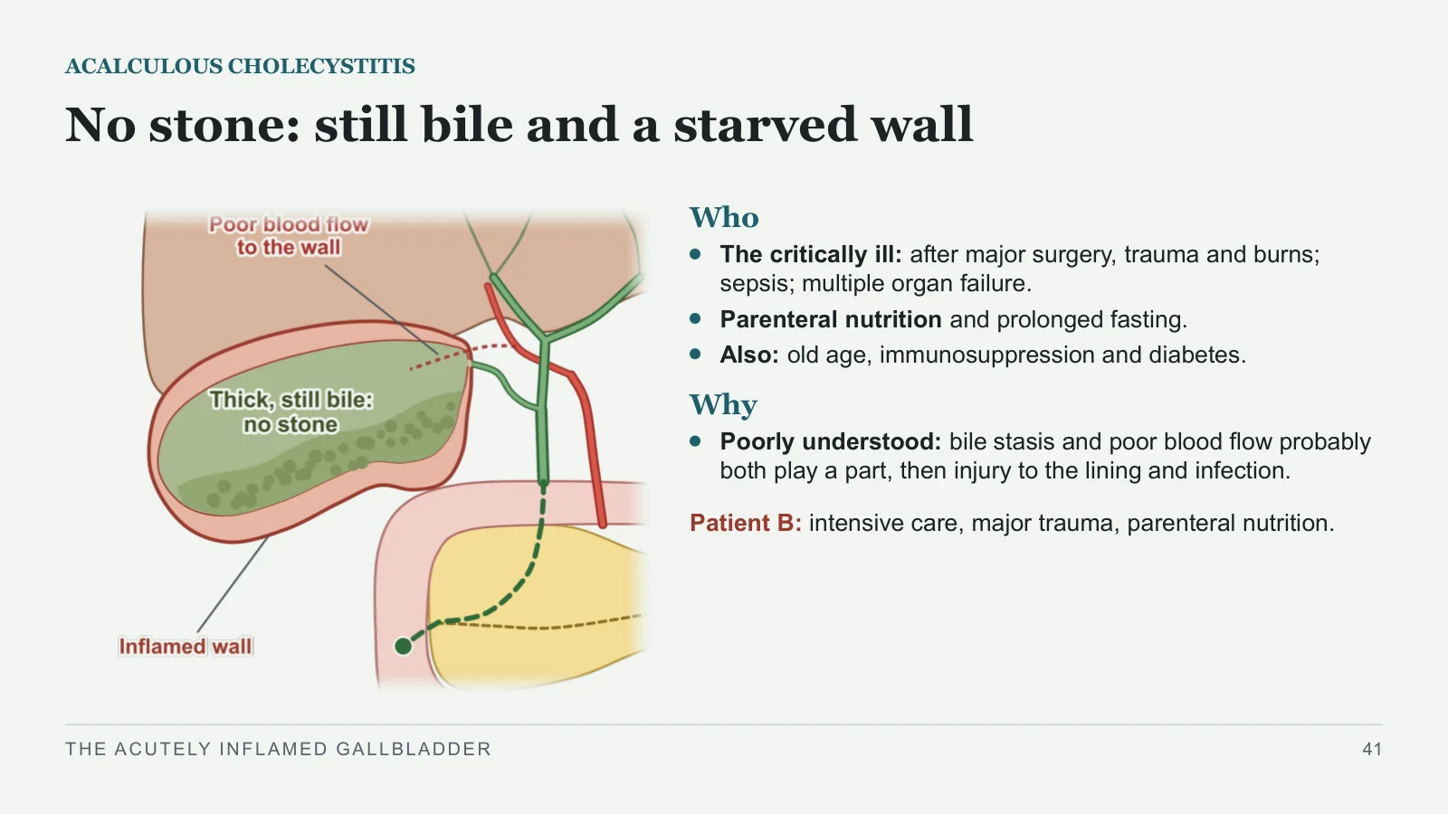 Slide 41: No stone: still bile and a starved wall