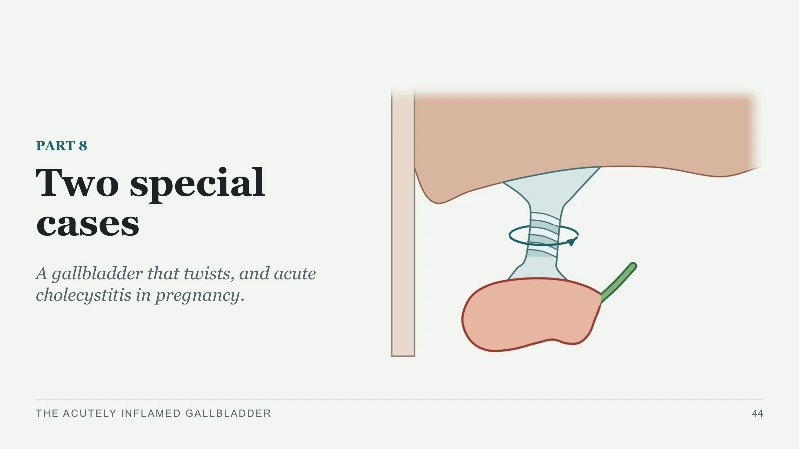 Slide 44: Two special cases
