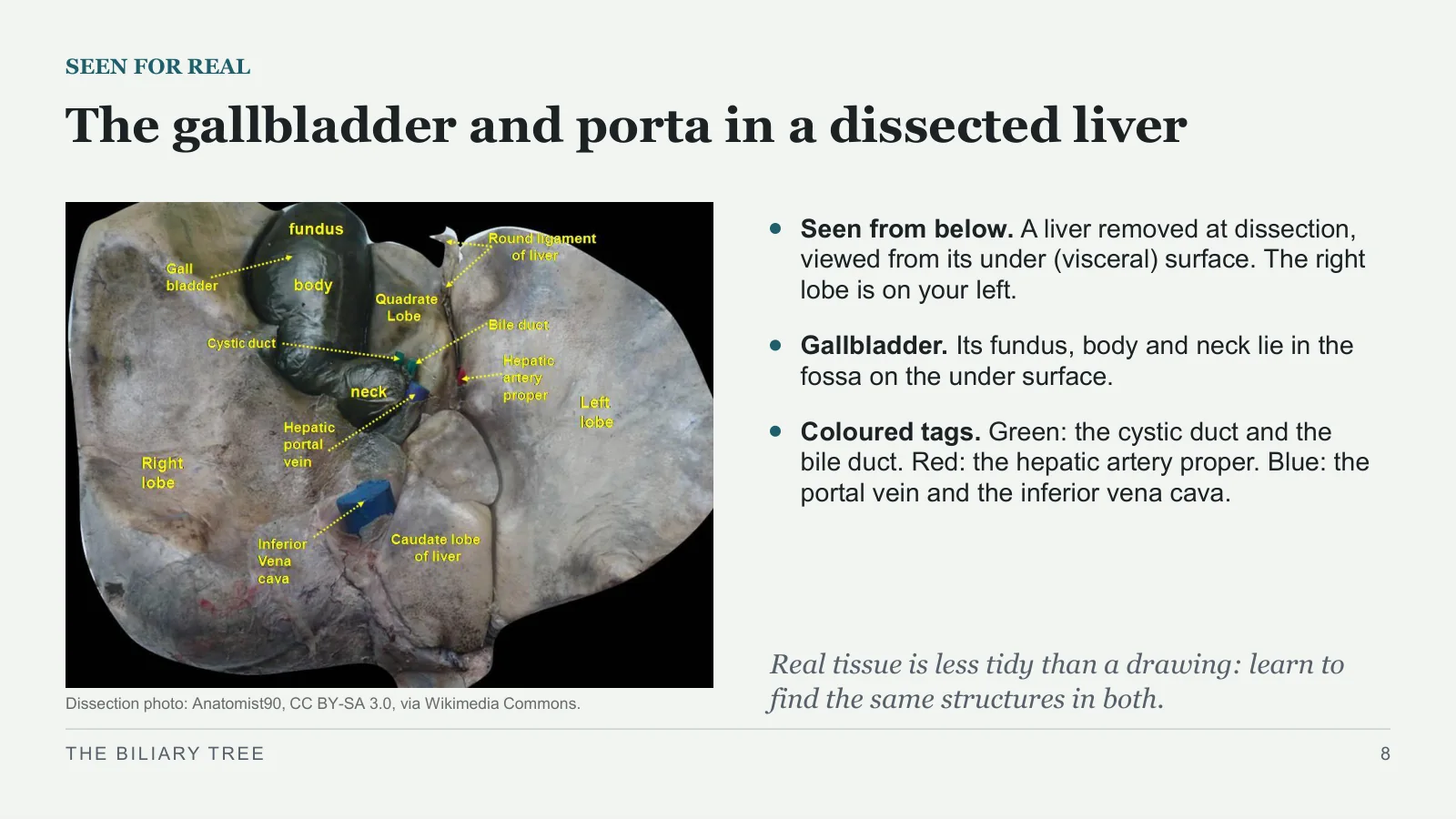 Slide 8: The gallbladder and porta in a dissected liver