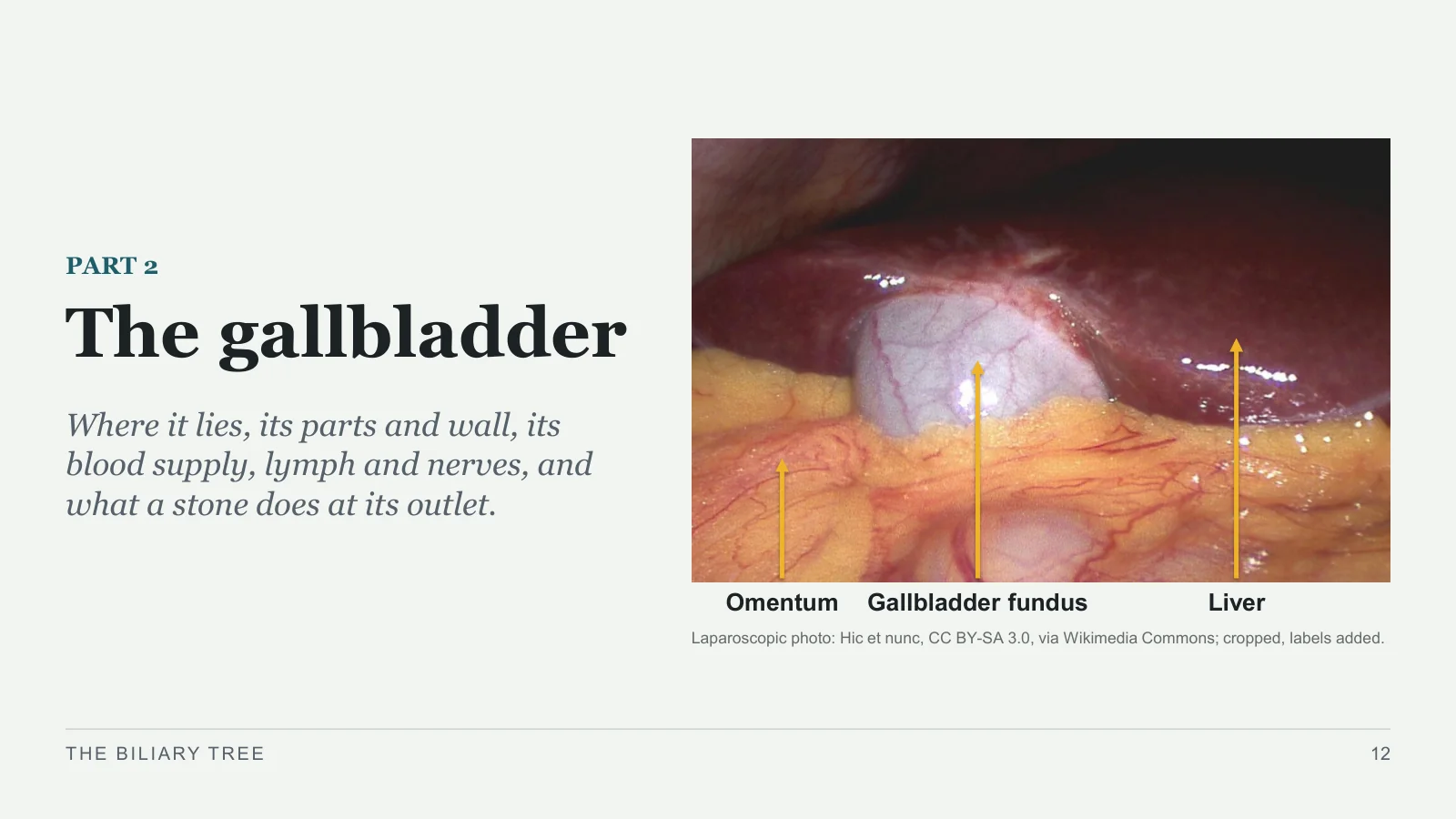 Slide 12: The gallbladder
