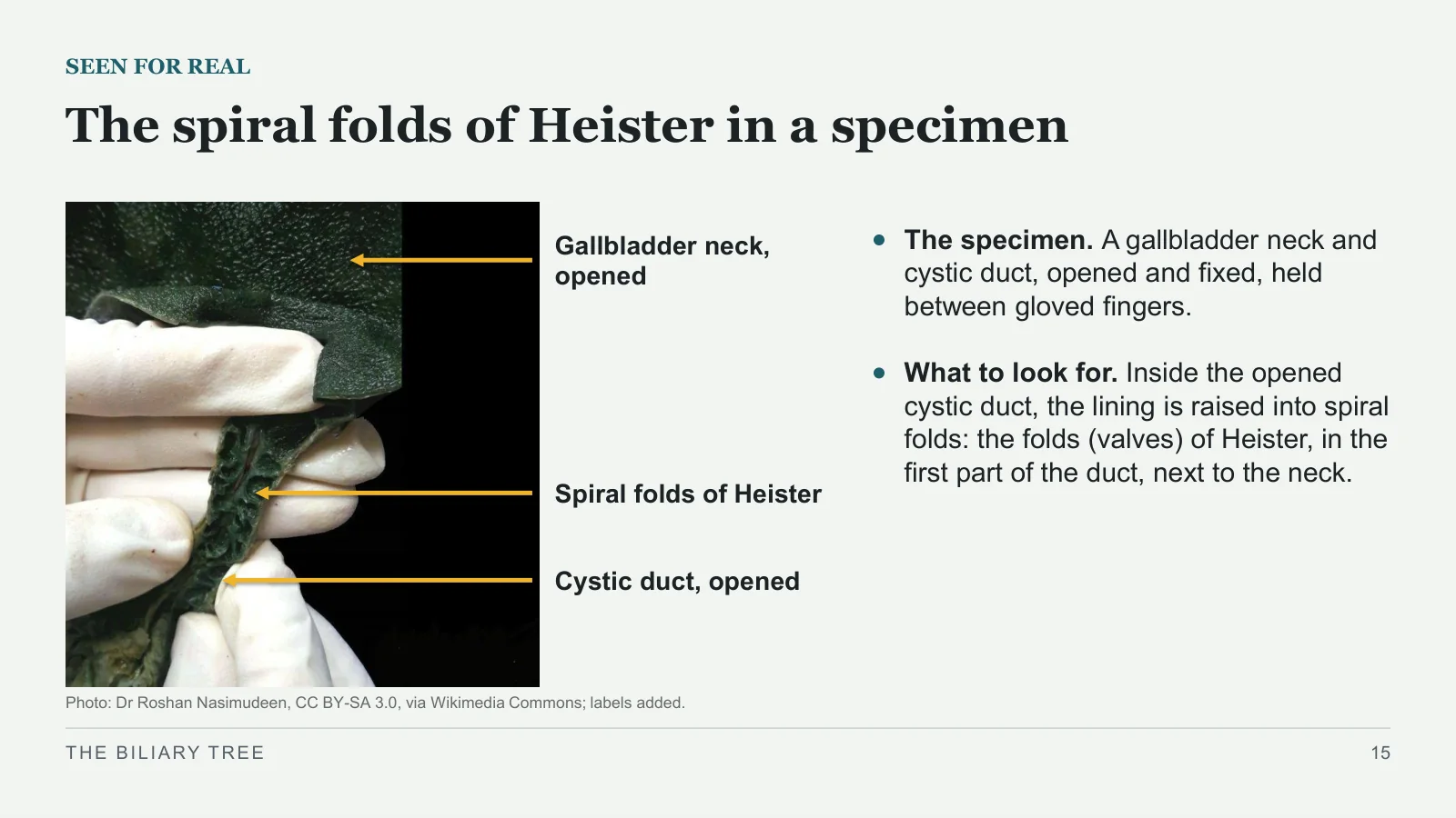 Slide 15: The spiral folds of Heister in a specimen