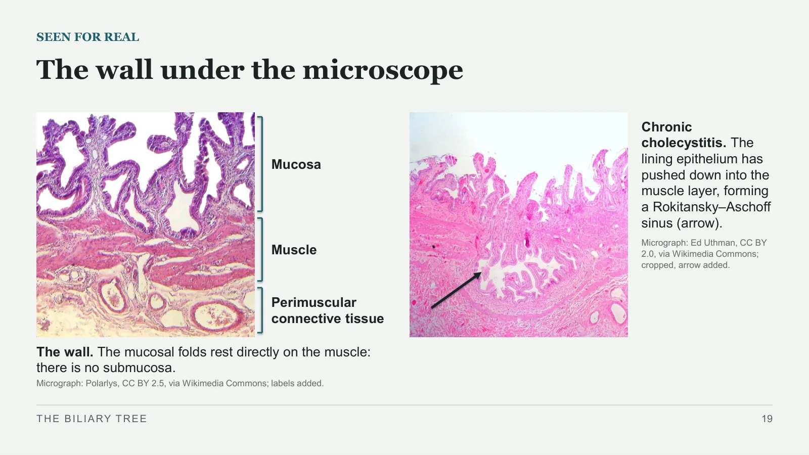 Slide 19: The wall under the microscope