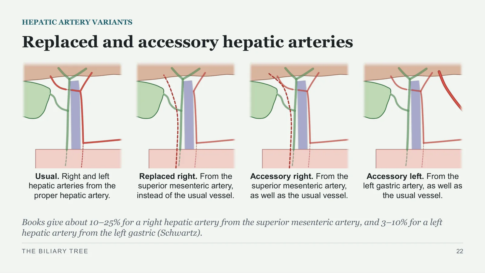 Slide 22: Replaced and accessory hepatic arteries