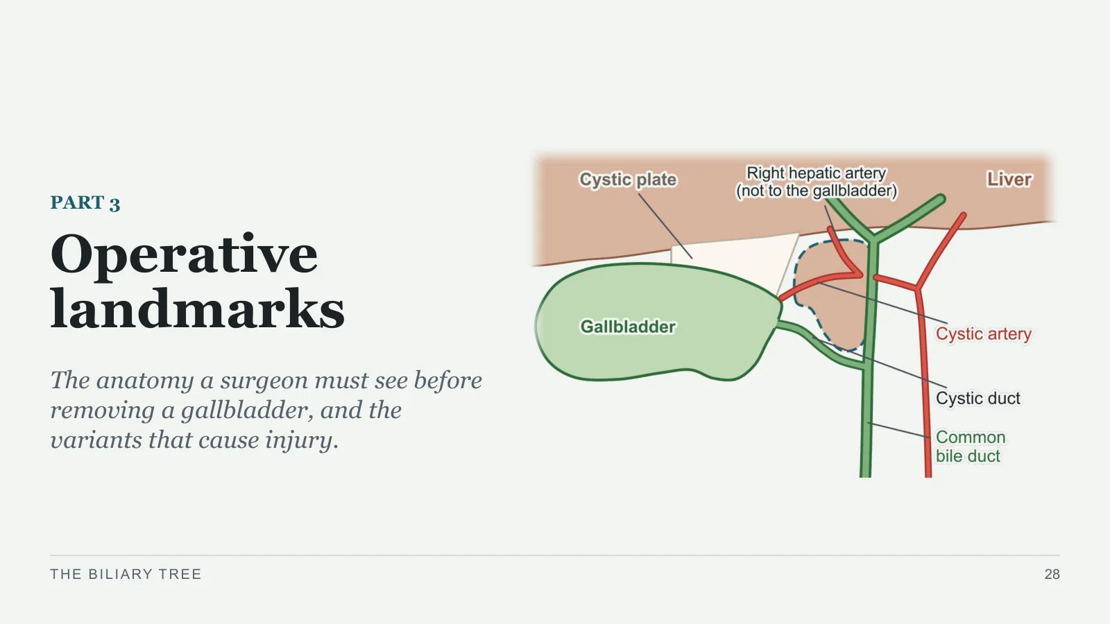 Slide 28: Operative landmarks