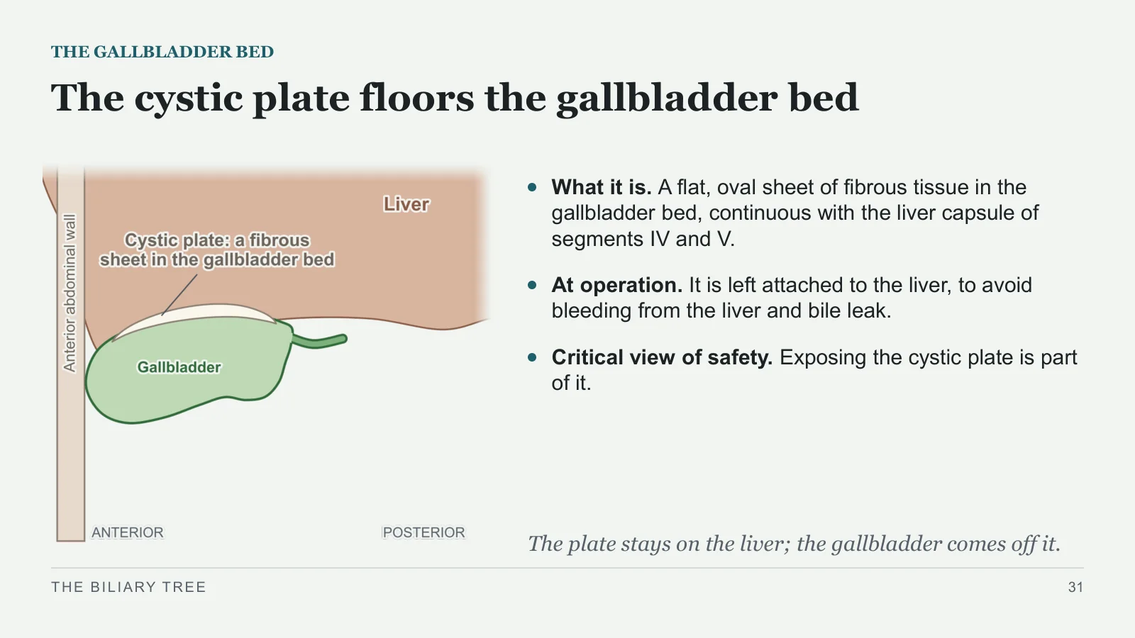 Slide 31: The cystic plate floors the gallbladder bed