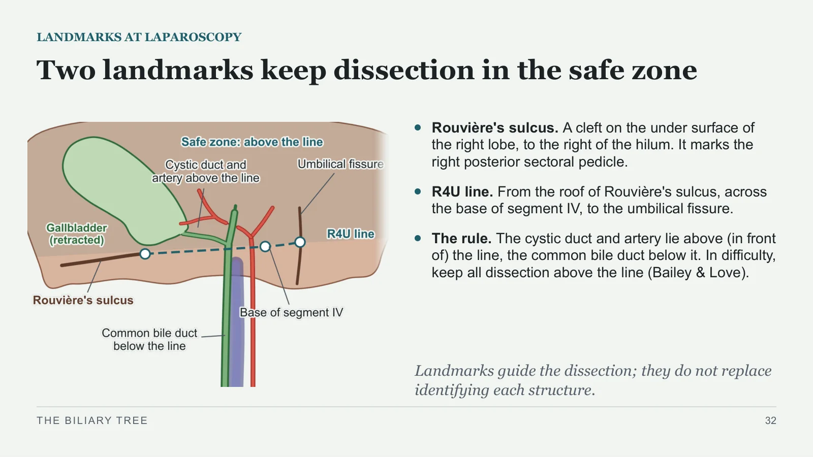 Slide 32: Two landmarks keep dissection in the safe zone