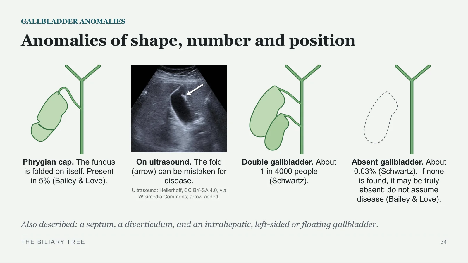 Slide 34: Anomalies of shape, number and position