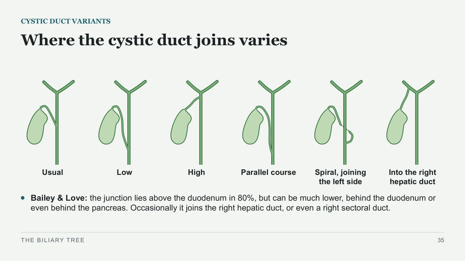 Slide 35: Where the cystic duct joins varies