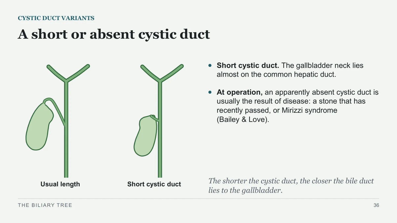 Slide 36: A short or absent cystic duct