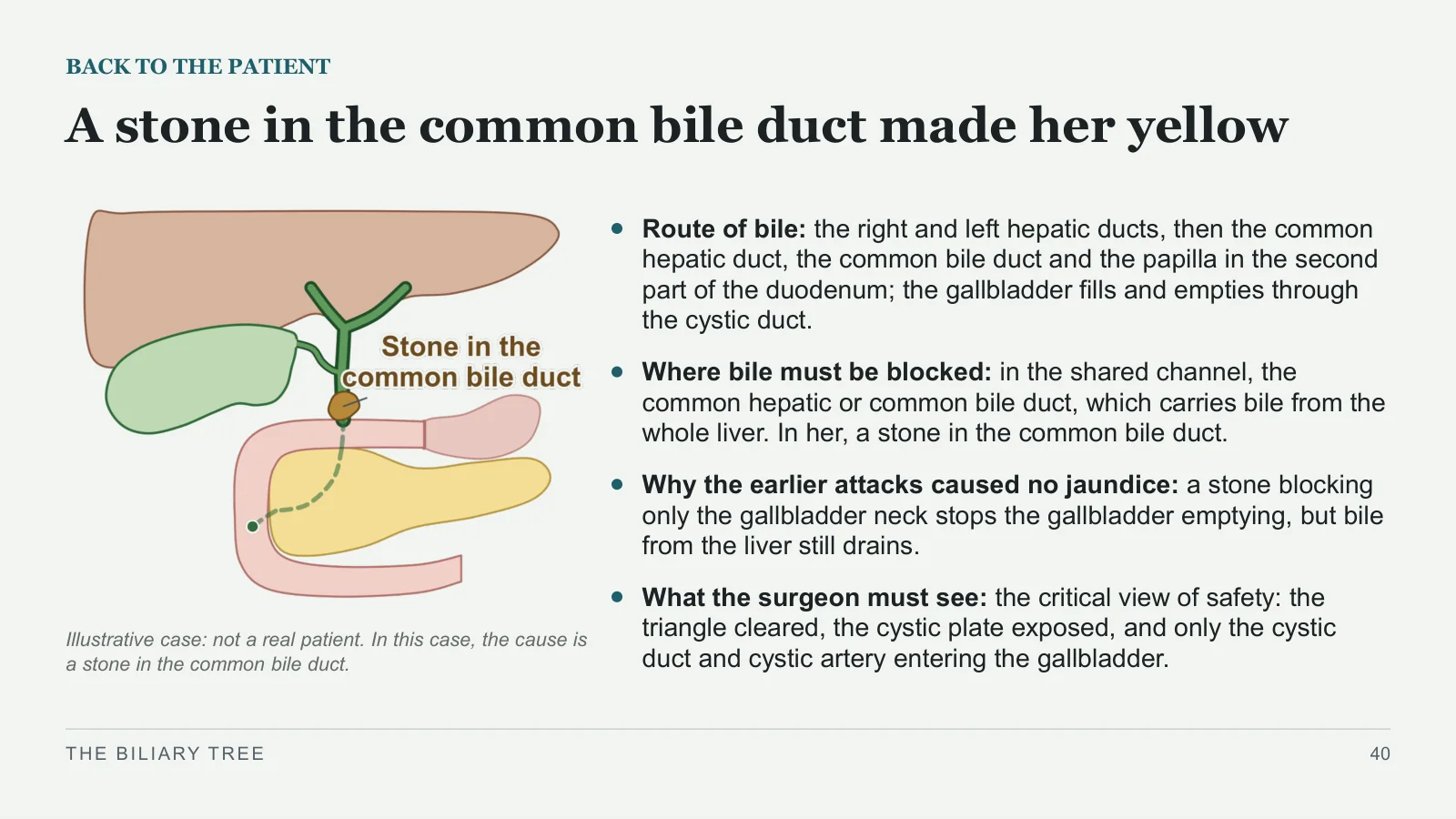 Slide 40: A stone in the common bile duct made her yellow