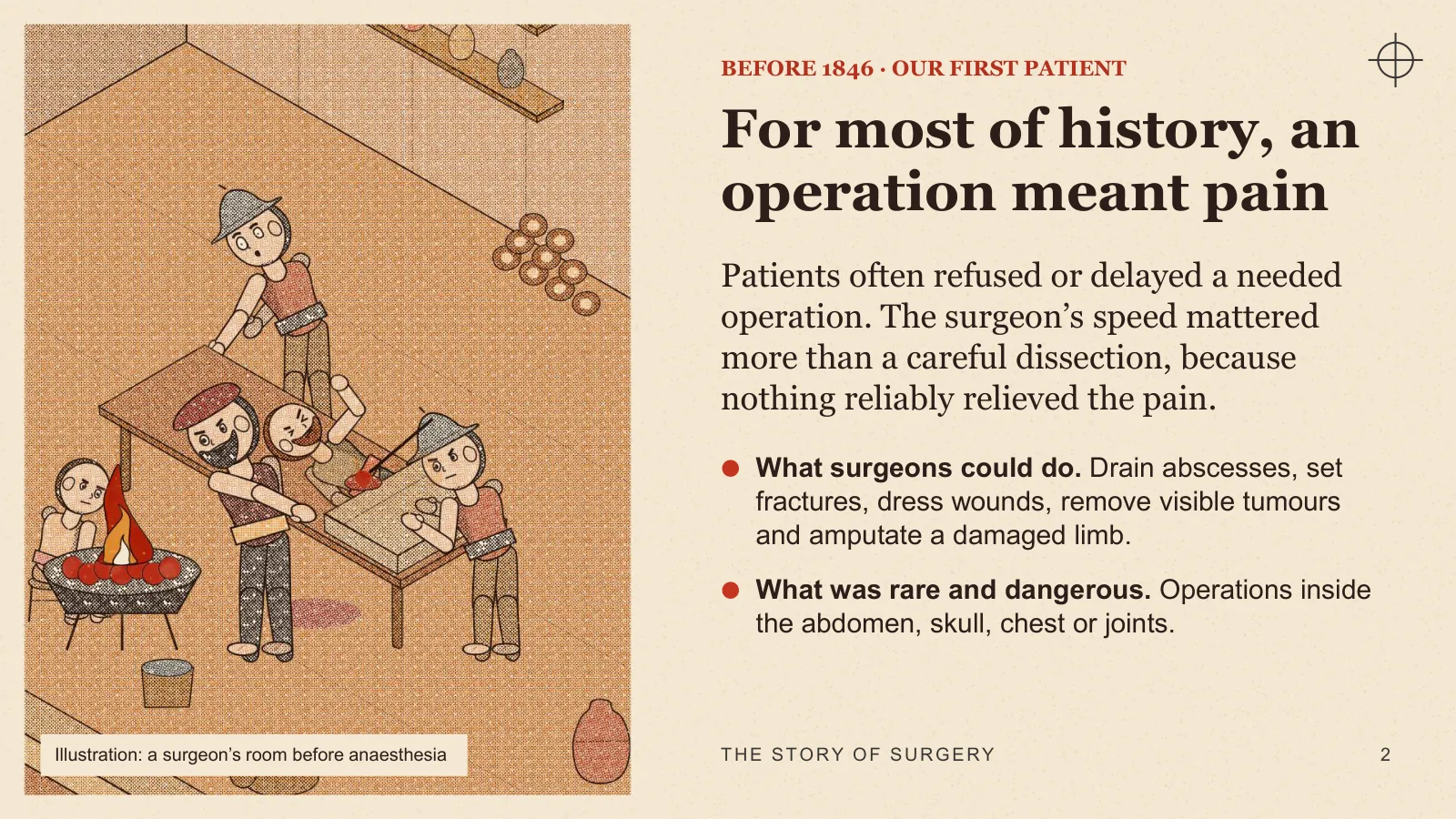 Slide 2: For most of history, an operation meant pain