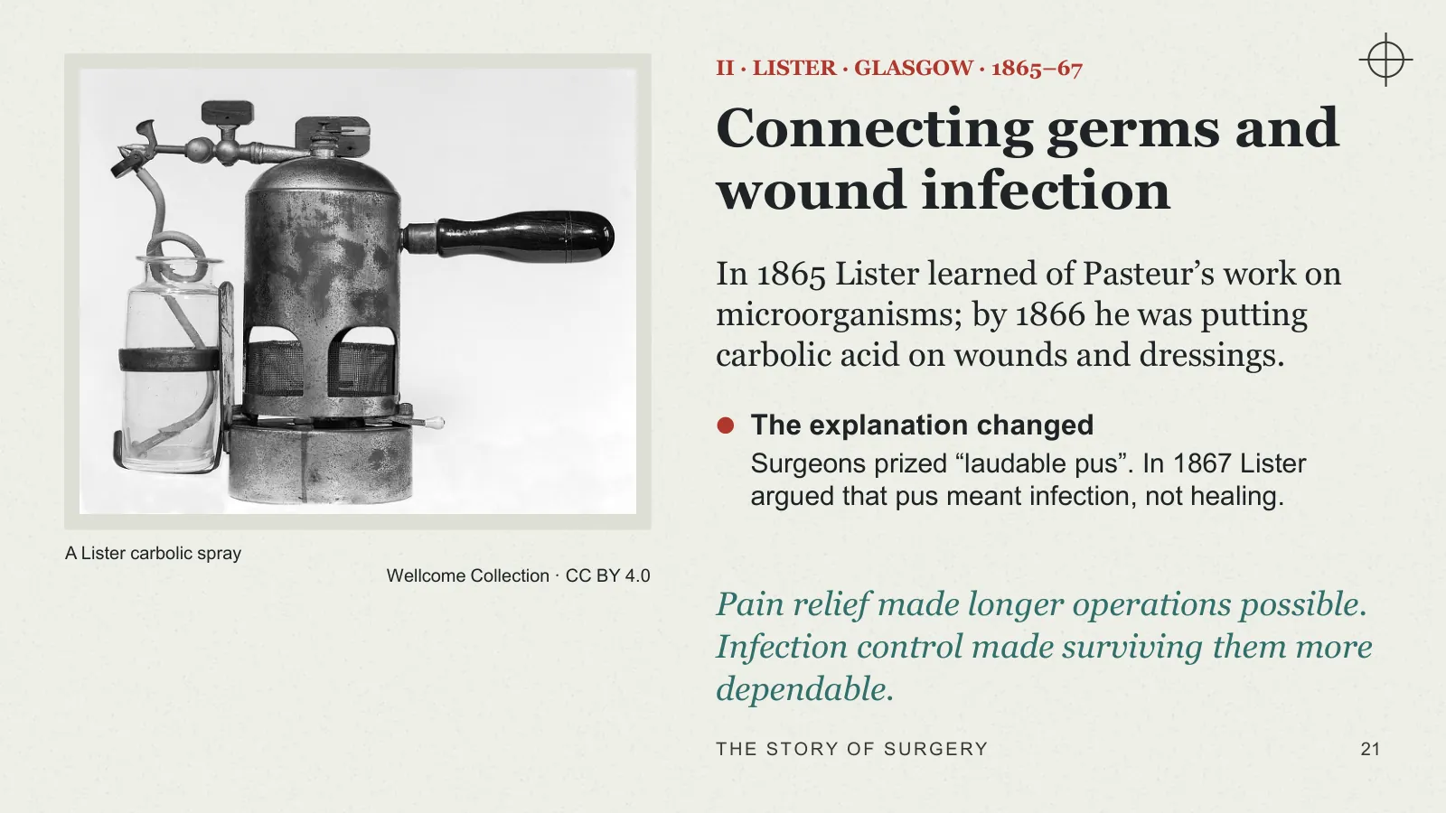 Slide 21: Connecting germs and wound infection