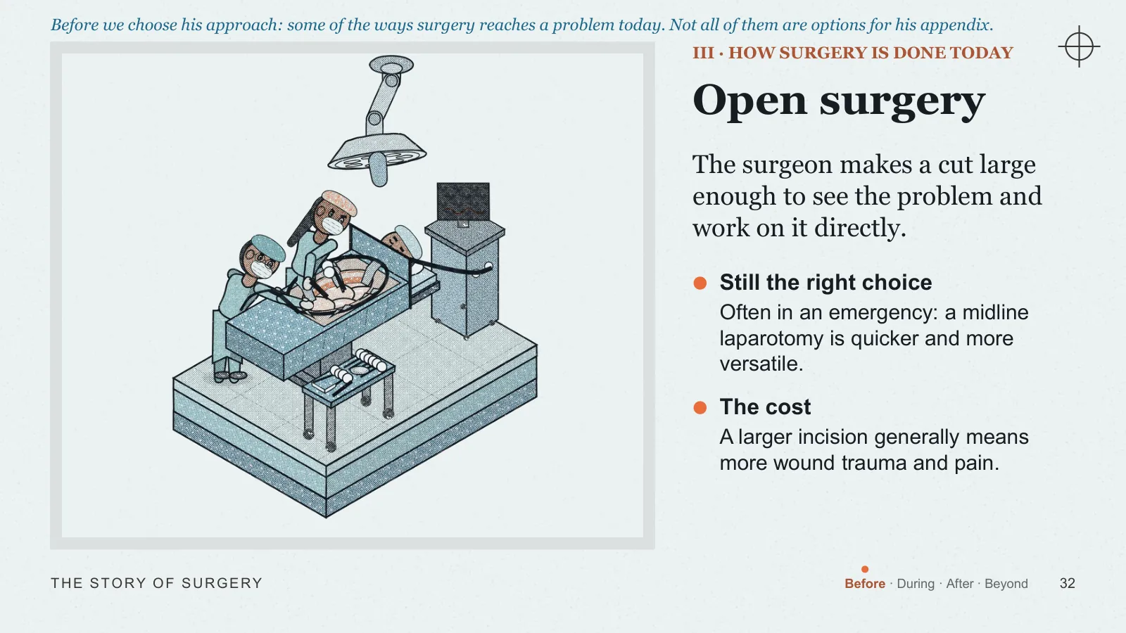 Slide 32: Open surgery