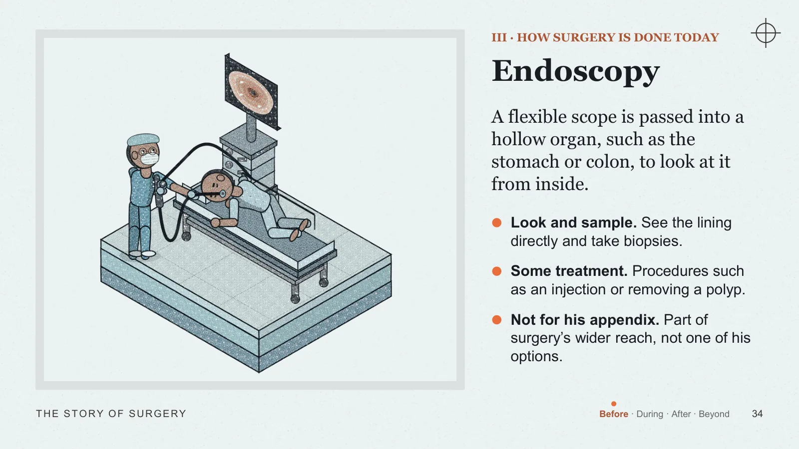 Slide 34: Endoscopy