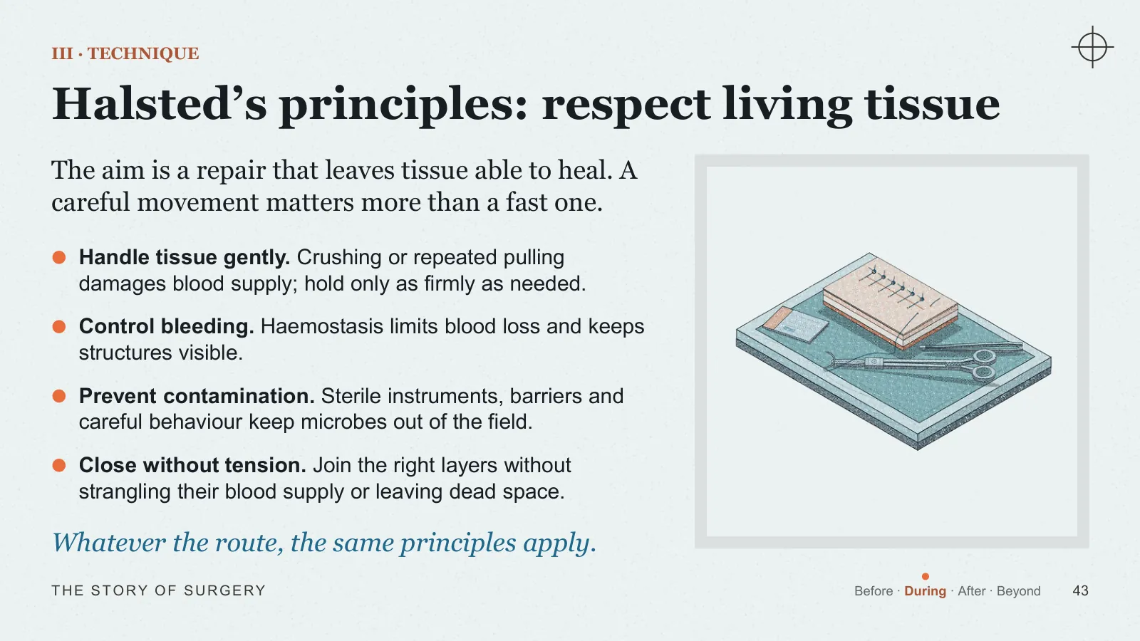 Slide 43: Halsted’s principles: respect living tissue